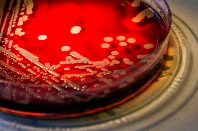 S. aureus bacterie
